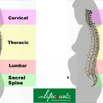 Obesity and Backache